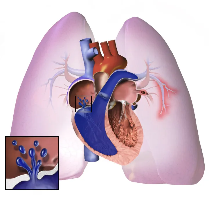 When a Cardiac Drug Becomes a Lung Treatment: Tadalafil's Expanding Role in Respiratory Medicine