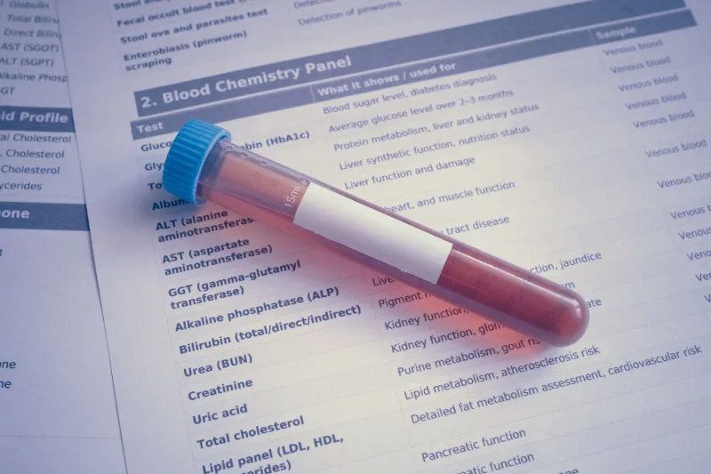 More Than a Low Drive: How Declining Testosterone Silently Undermines Men's Sexual Health